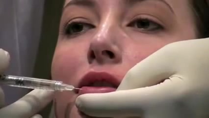 Ювидерм для увеличения губ