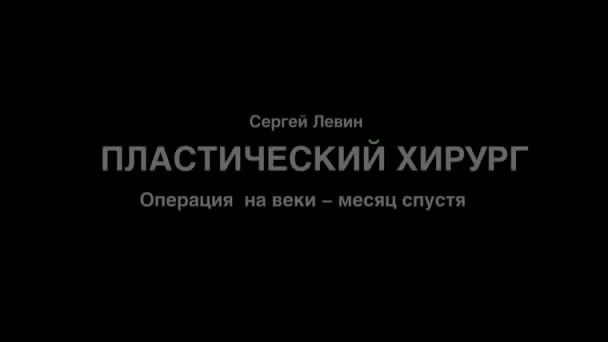 Результат пластики век
