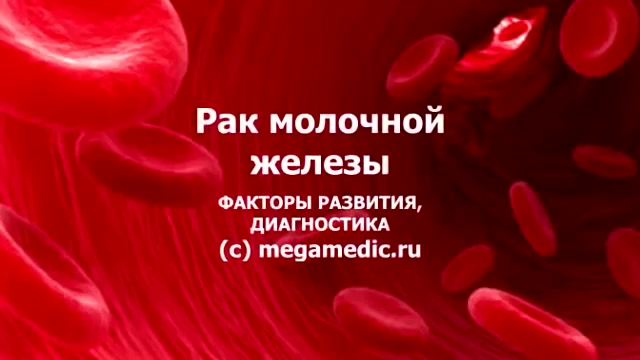 Рак молочной железы: причины и лечение