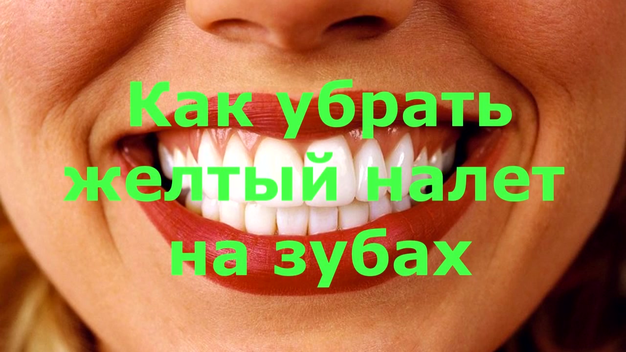 Жовтий наліт на зубах, способи відбілювання зубів домашніх умовах